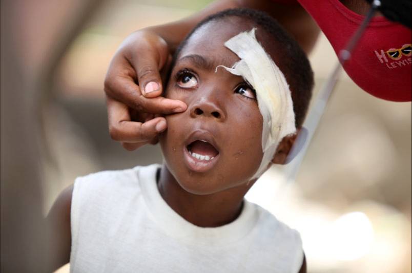 McBride_Haitibandagedchild