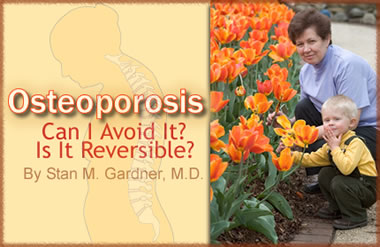 Osteoporosis: Can I Avoid It? Is It Reversible?